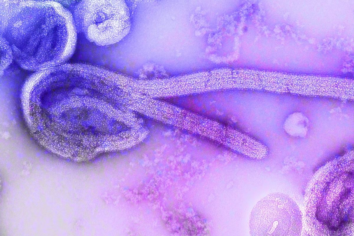 CDC Alt